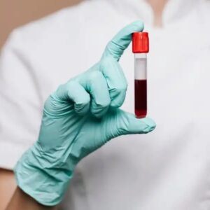 Creatinine Clearance